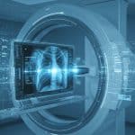 Comment l’IA Révolutionne l’Imagerie Médicale en 2025