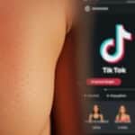 Danger des Burn Lines : La Tendance TikTok à Éviter