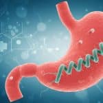 Helicobacter Pylori : La Bactérie Derrière le Cancer Gastrique