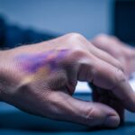 Donald Trump et son ecchymose à la main : que cache ce bleu ?