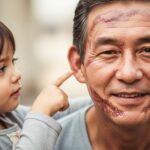 Grand Brûlé Après un Accident Électrique : Témoignage Touchant