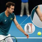 Thanasi Kokkinakis : Un Tendon d'Achille de Donneurs dans le Bras